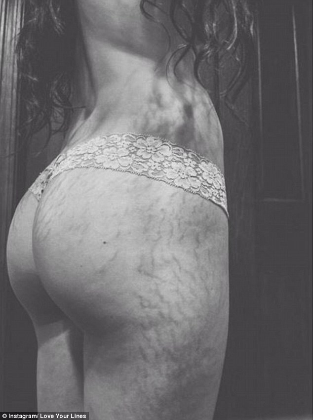 Instagram Love Your Lines, инстаграм растяжки, полюби свои растяжки