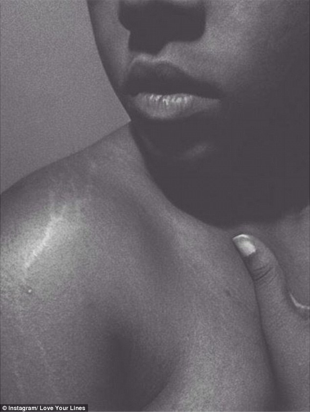 Instagram Love Your Lines, инстаграм растяжки, полюби свои растяжки