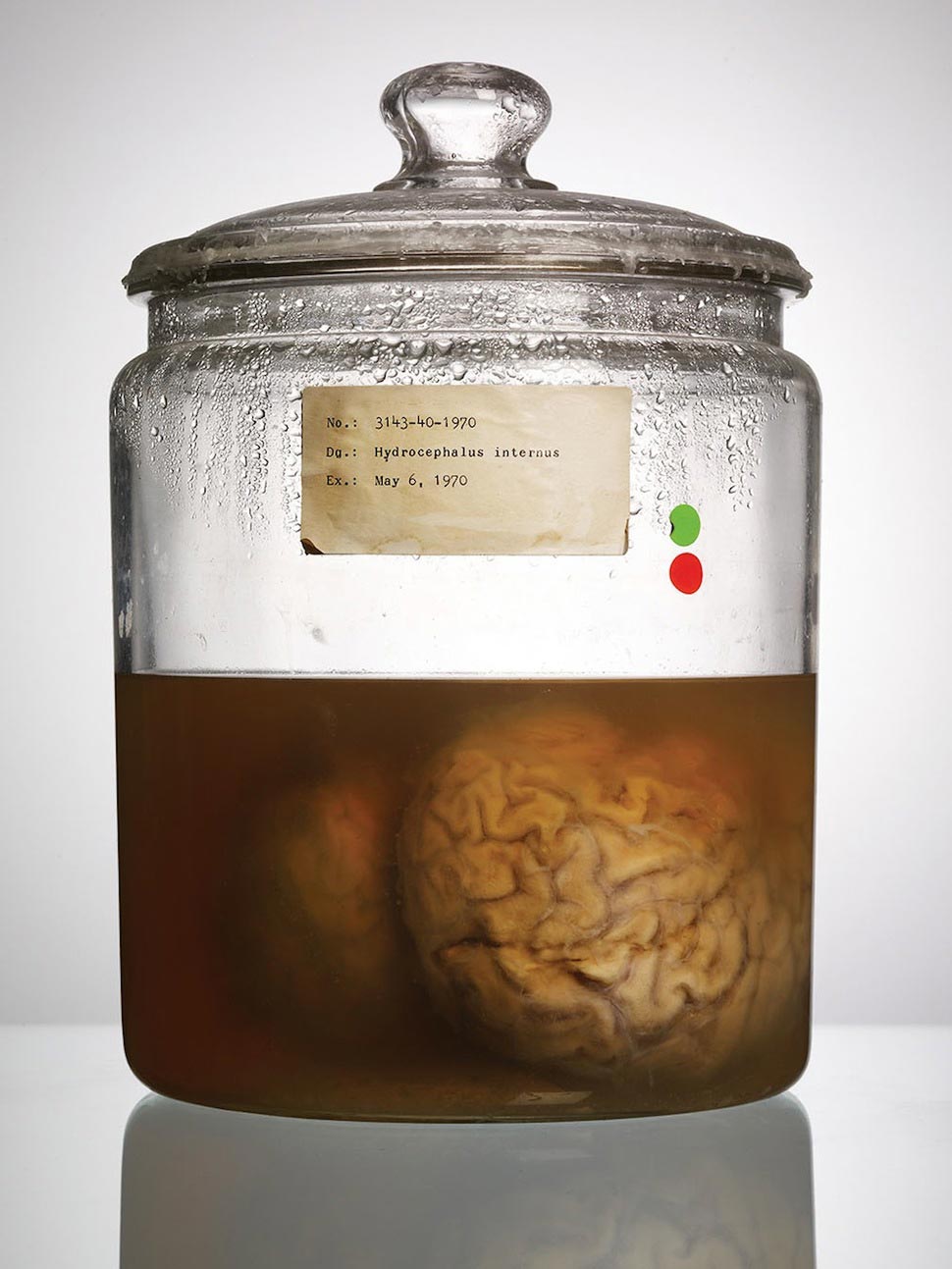 мозги психбольницы Техаса, мозги пациентов в банках, Адам Вурхес,Adam Voorhes