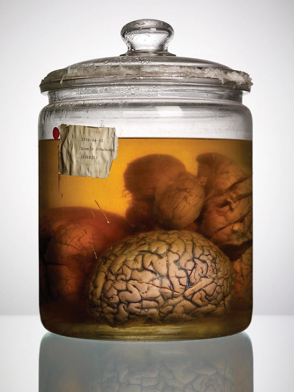 мозги психбольницы Техаса, мозги пациентов в банках, Адам Вурхес,Adam Voorhes