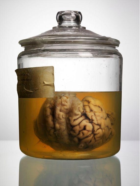 мозги психбольницы Техаса, мозги пациентов в банках, Адам Вурхес,Adam Voorhes