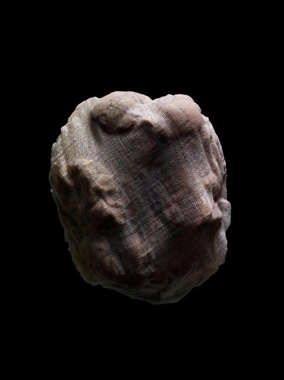 мозги психбольницы Техаса, мозги пациентов в банках, Адам Вурхес,Adam Voorhes