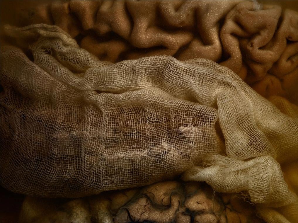 мозги психбольницы Техаса, мозги пациентов в банках, Адам Вурхес,Adam Voorhes