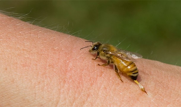 25 самых распространенных причин смерти самые частые, самые распространенные, причины смерти, случаи, статистика