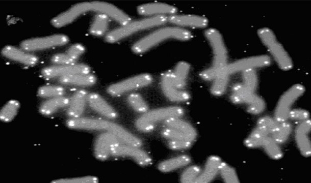 25 самых распространенных причин смерти самые частые, самые распространенные, причины смерти, случаи, статистика