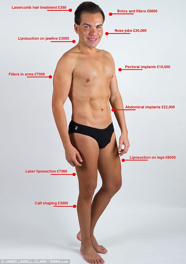 Родриго Алвес пластические операции, Rodrigo Alves