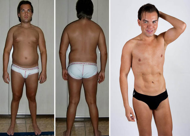 Родриго Алвес пластические операции, Rodrigo Alves