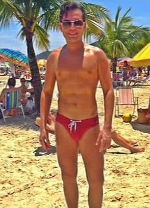 Родриго Алвес пластические операции, Rodrigo Alves