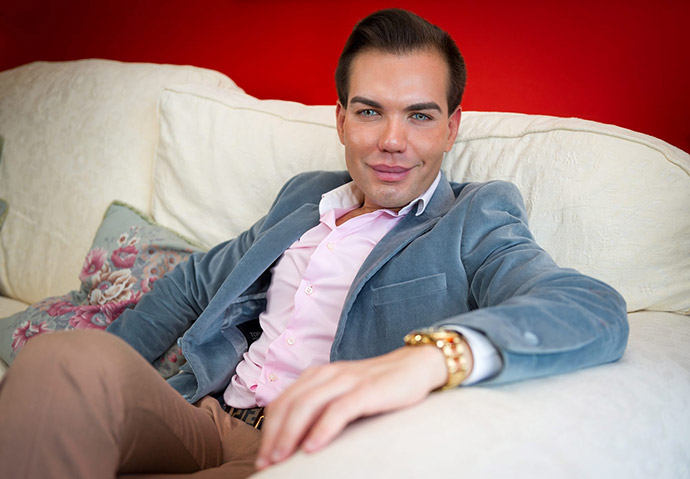 Родриго Алвес пластические операции, Rodrigo Alves