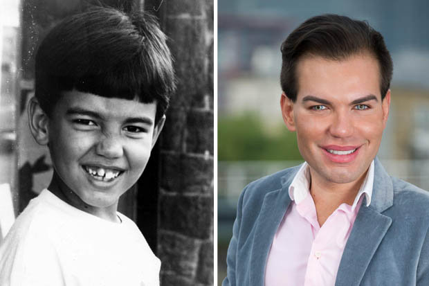 Родриго Алвес пластические операции, Rodrigo Alves
