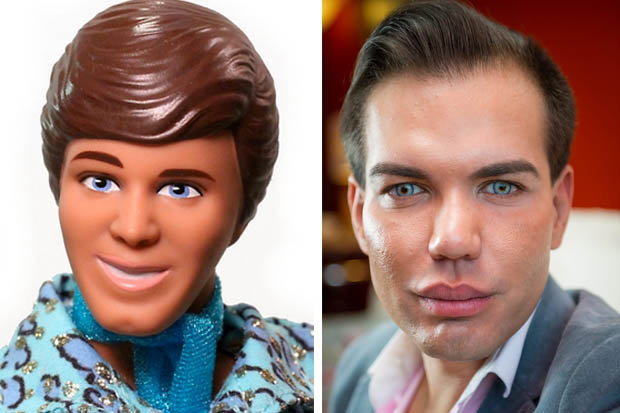 Родриго Алвес пластические операции, Rodrigo Alves