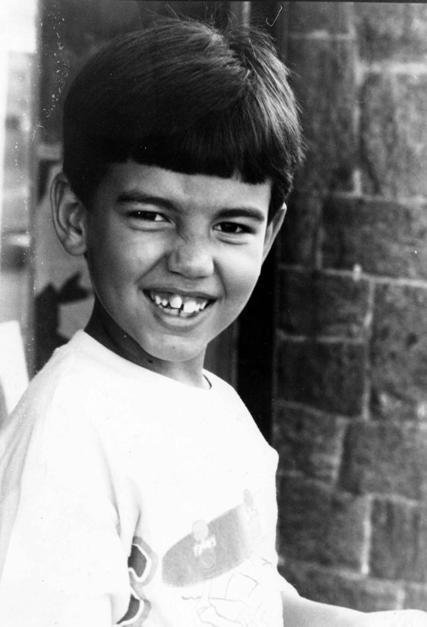 Родриго Алвес пластические операции, Rodrigo Alves