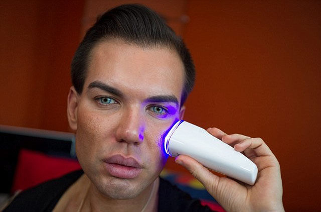 Родриго Алвес пластические операции, Rodrigo Alves