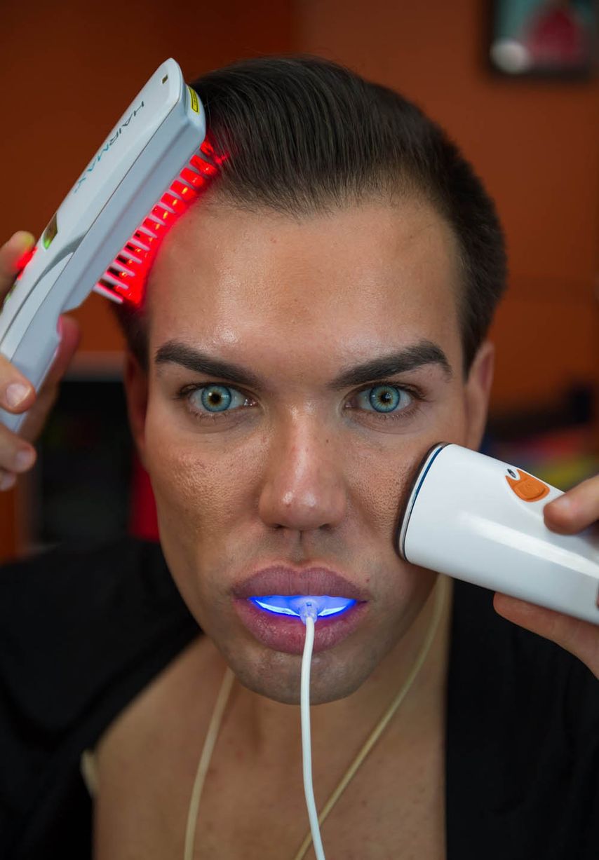 Родриго Алвес пластические операции, Rodrigo Alves