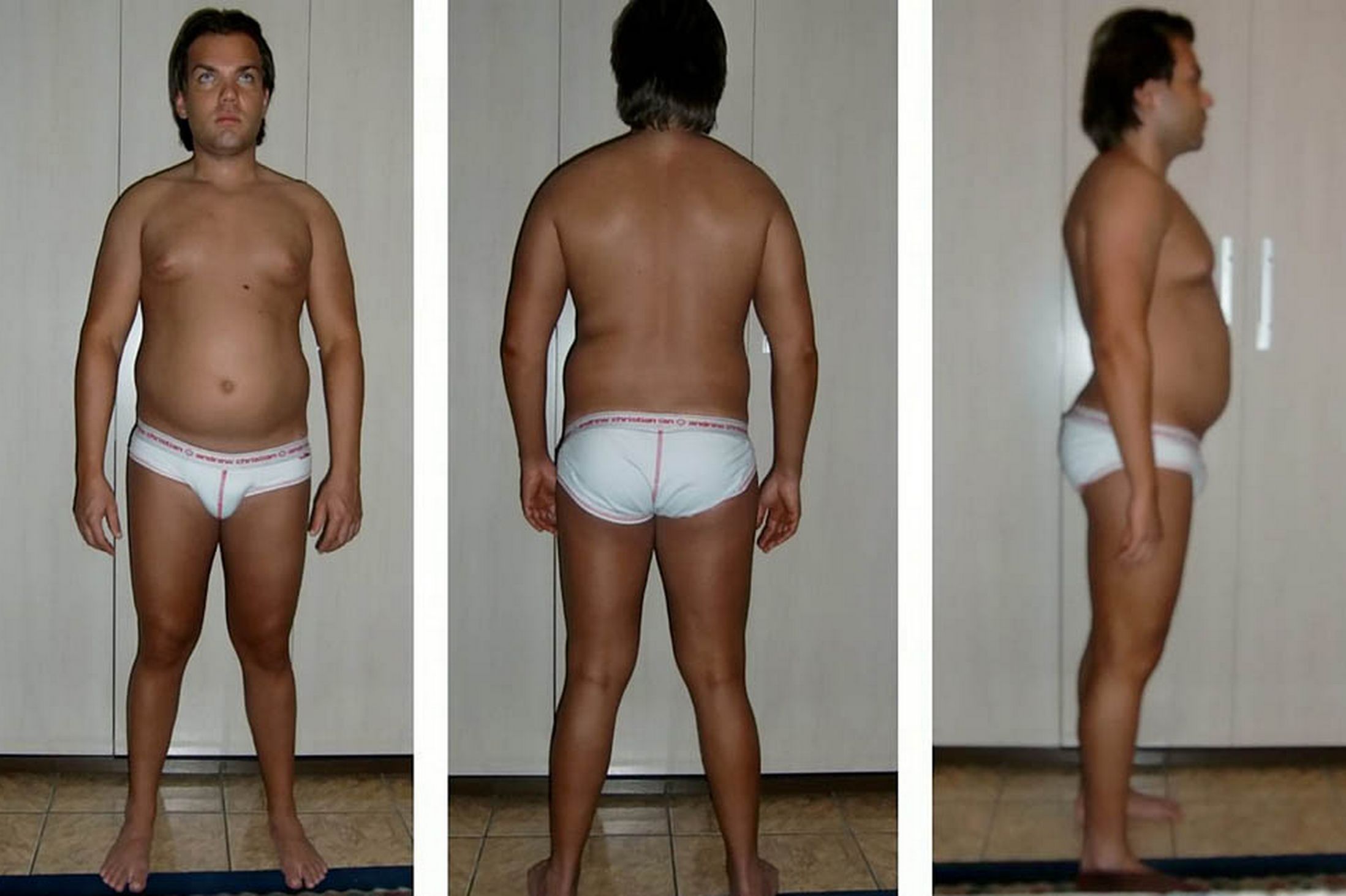 Родриго Алвес пластические операции, Rodrigo Alves