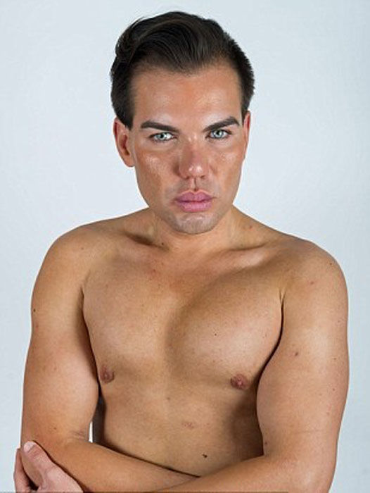 Родриго Алвес пластические операции, Rodrigo Alves