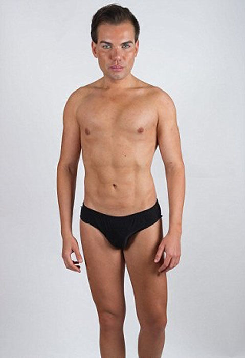 Родриго Алвес пластические операции, Rodrigo Alves