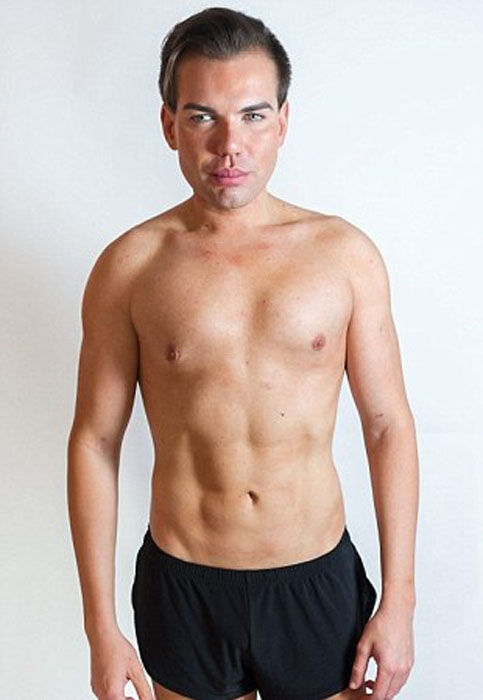 Родриго Алвес пластические операции, Rodrigo Alves