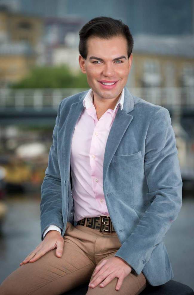 Родриго Алвес пластические операции, Rodrigo Alves