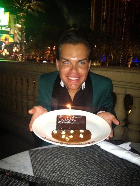 Родриго Алвес пластические операции, Rodrigo Alves