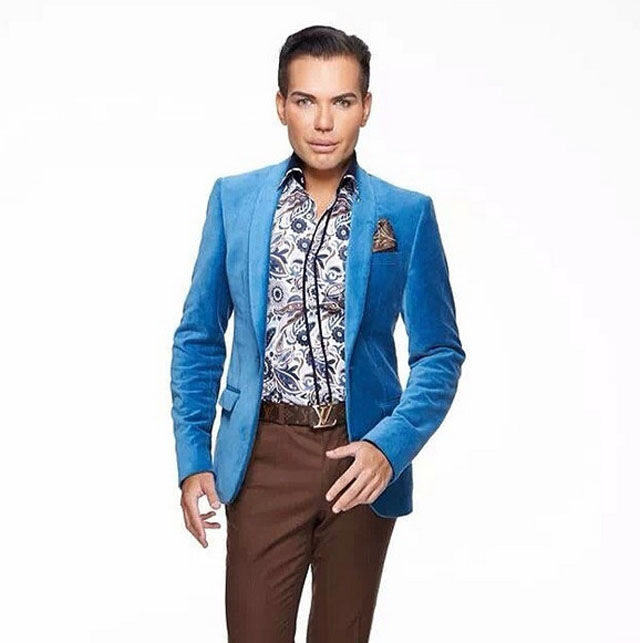 Родриго Алвес пластические операции, Rodrigo Alves