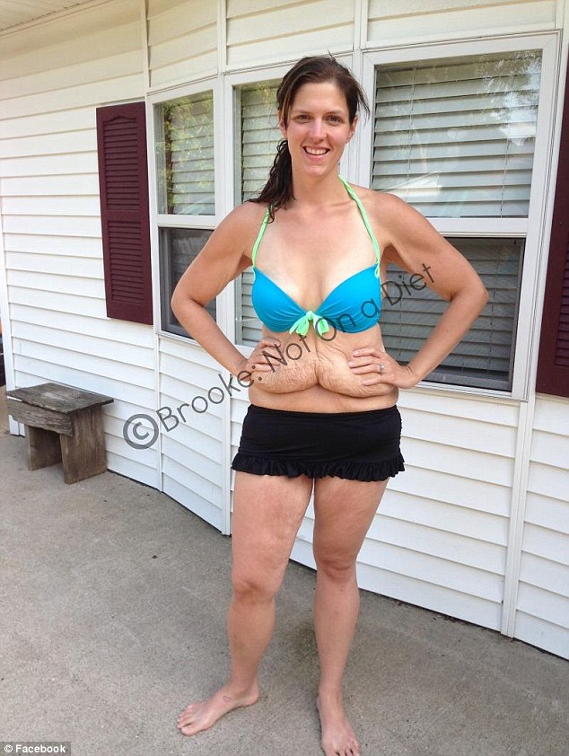 Shape не принял фото похудевшей девушки, журнал отказался взять фото девушки, обвисший живот после похудения, лишняя кожа после похудения