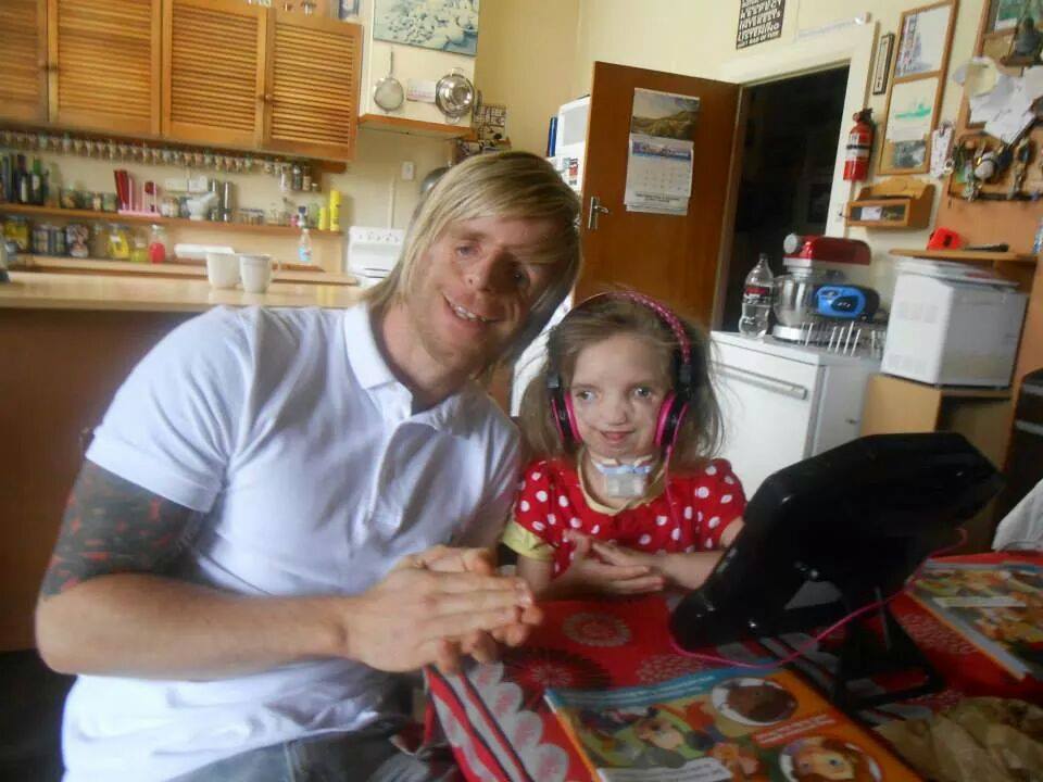 Джоно Ланкастер, Jono Lancaster, Синдром Тричера Коллинза, Treacher Collins syndrome