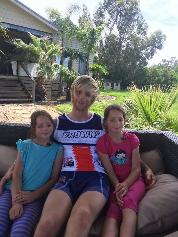 Джоно Ланкастер, Jono Lancaster, Синдром Тричера Коллинза, Treacher Collins syndrome