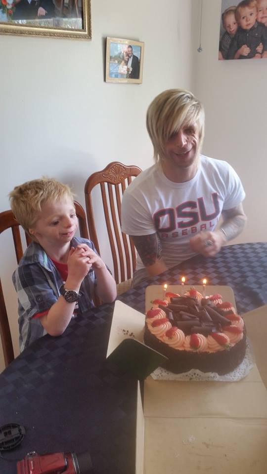 Джоно Ланкастер, Jono Lancaster, Синдром Тричера Коллинза, Treacher Collins syndrome