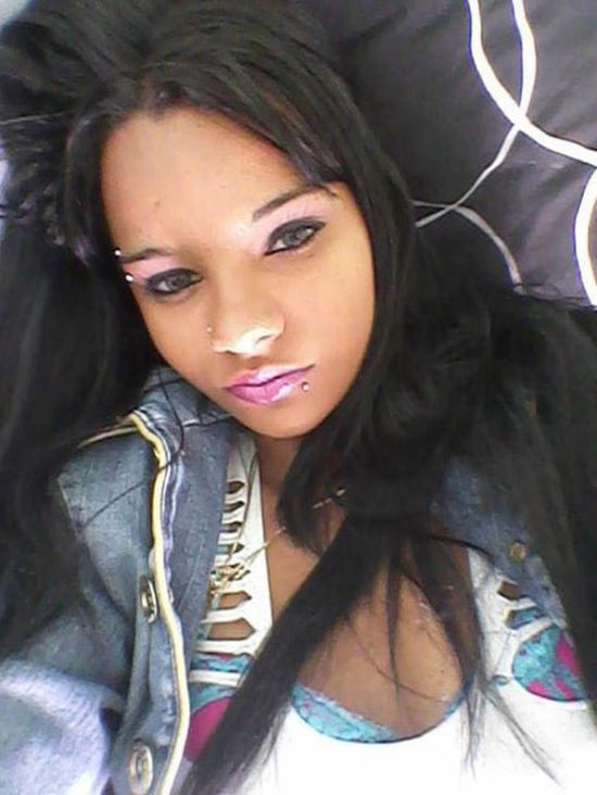 после увеличения груди, девушка стала инвалидом, linda perez, кома