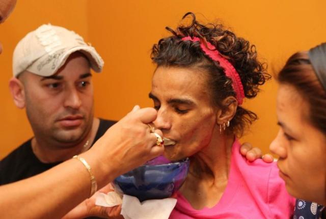 после увеличения груди, девушка стала инвалидом, linda perez, кома