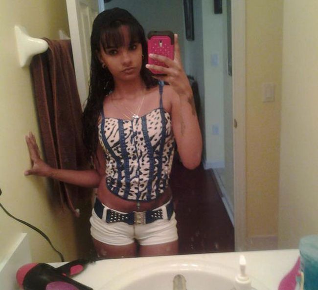 после увеличения груди, девушка стала инвалидом, linda perez, кома