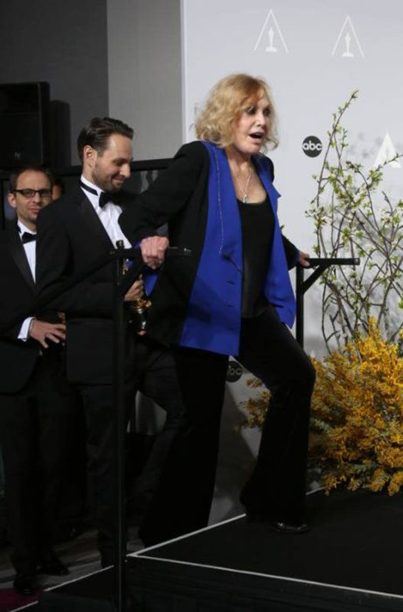 Ким новак после операции, пластическая операция Ким Новак, Ким Новак до и после