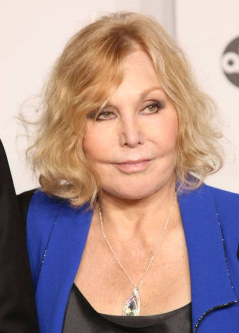 Ким новак после операции, пластическая операция Ким Новак, Ким Новак до и после