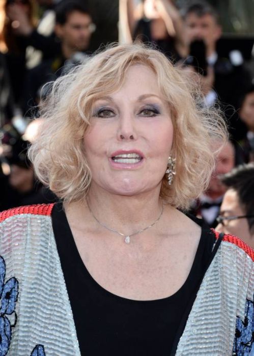 Ким новак после операции, пластическая операция Ким Новак, Ким Новак до и после