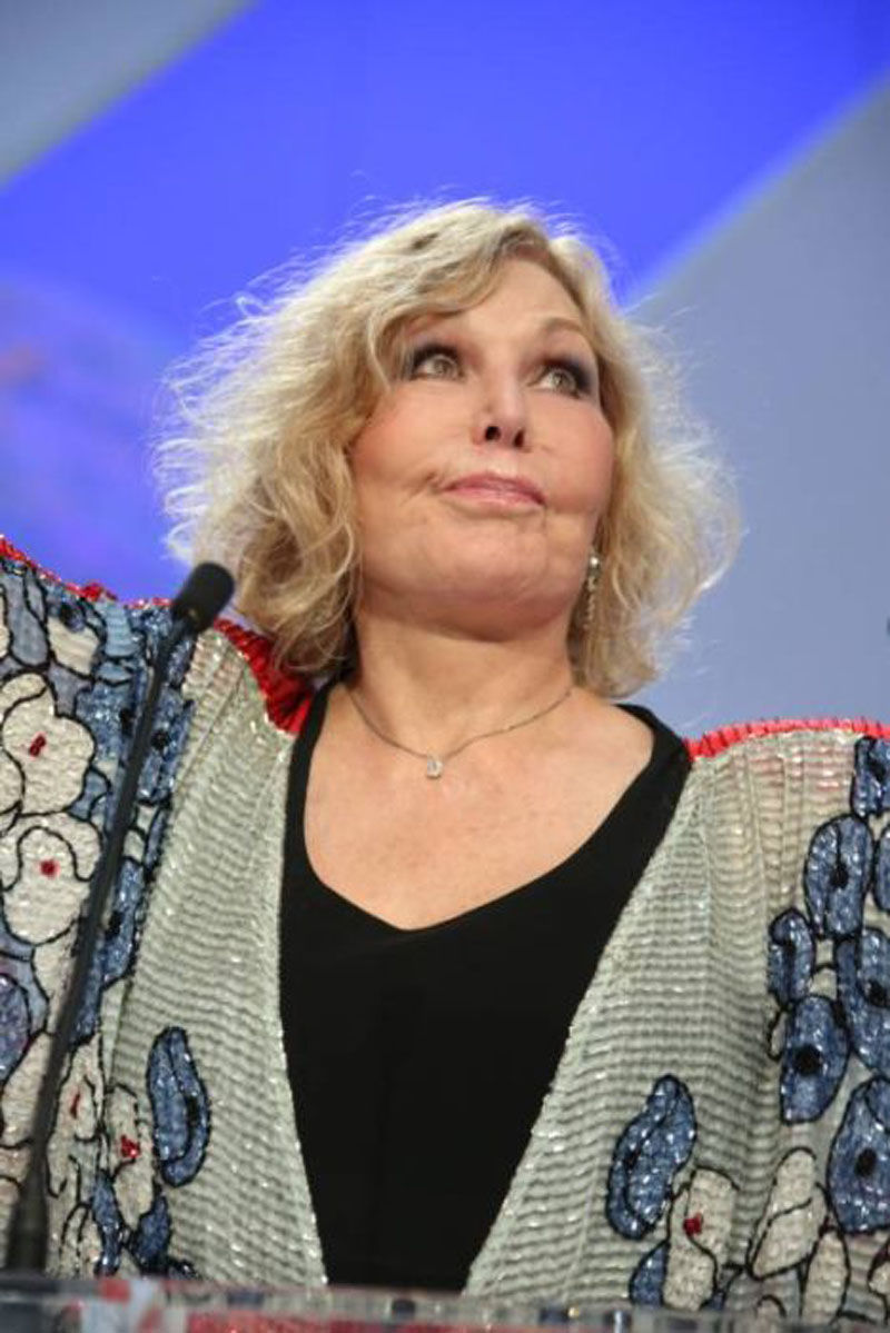 Ким новак после операции, пластическая операция Ким Новак, Ким Новак до и после