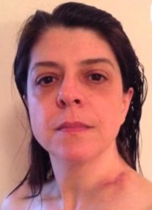 борьба с раком легких, видео рак, Дженнифер Гласс, Jennifer Glass, обнаружили рак