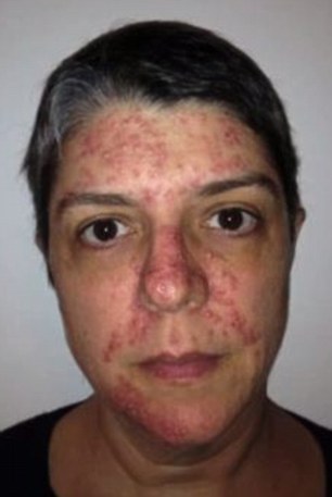 борьба с раком легких, видео рак, Дженнифер Гласс, Jennifer Glass, обнаружили рак