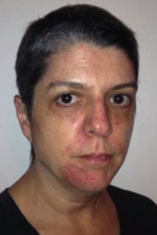 борьба с раком легких, видео рак, Дженнифер Гласс, Jennifer Glass, обнаружили рак