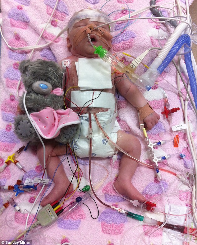 операция на сердце после рождения, Chanel Murrish