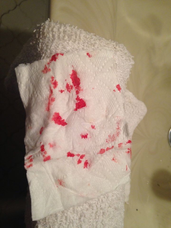 фотографии лица избил, женщину избил бывший, фото против насилия в семье, травмы лица женщина