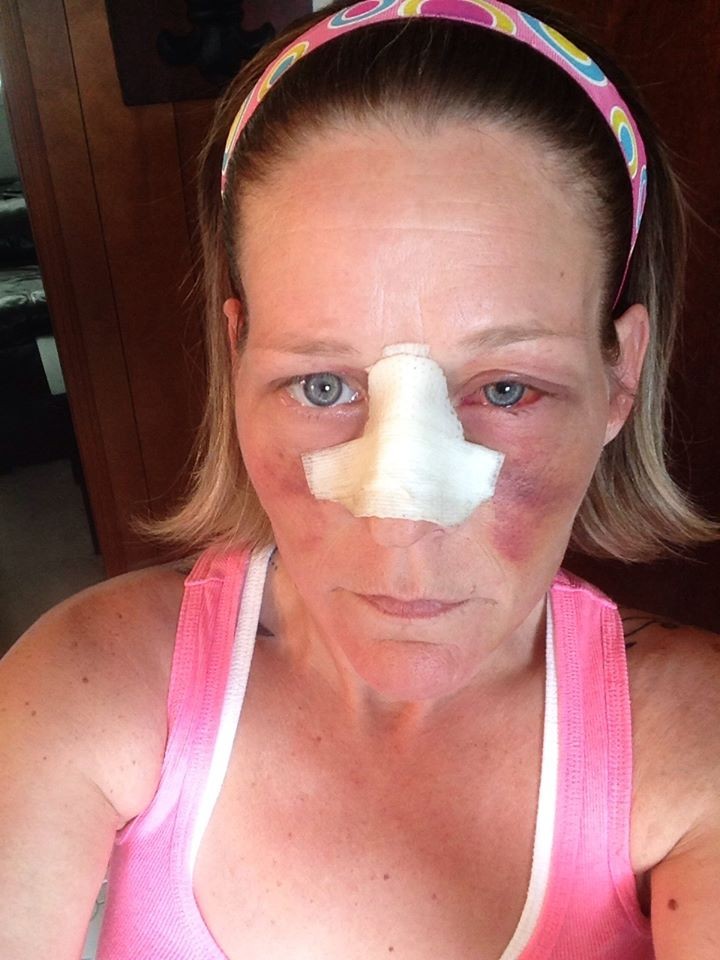 фотографии лица избил, женщину избил бывший, фото против насилия в семье, травмы лица женщина