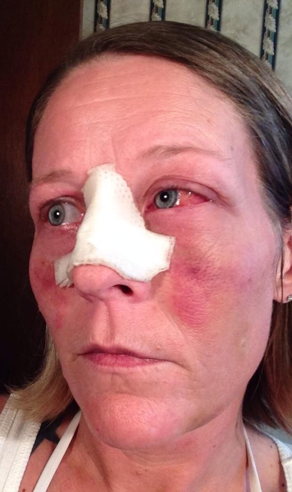 фотографии лица избил, женщину избил бывший, фото против насилия в семье, травмы лица женщина