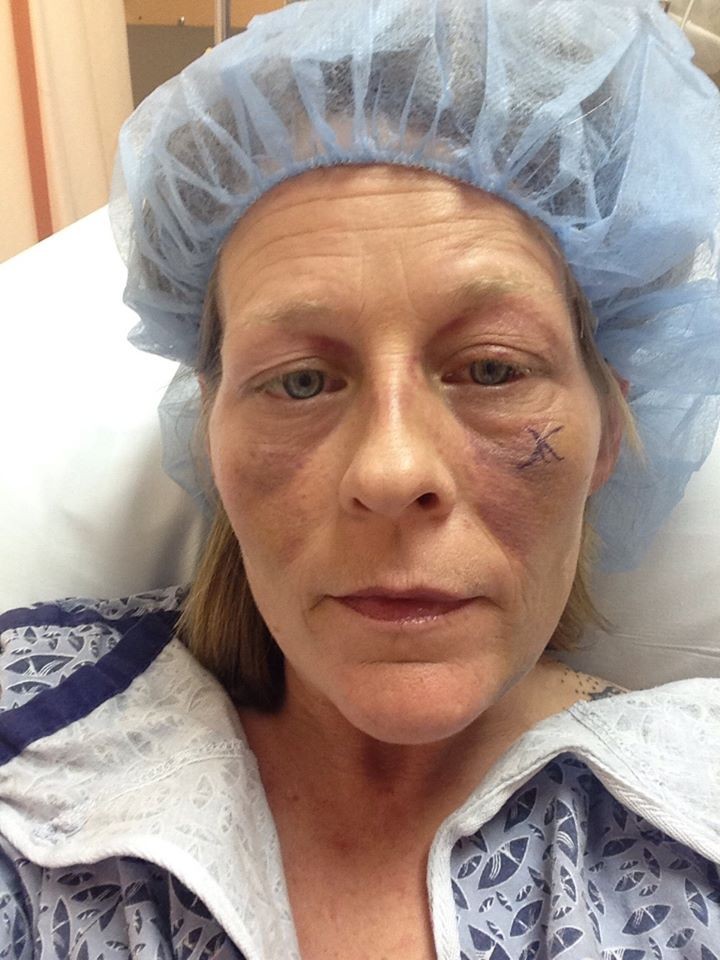 фотографии лица избил, женщину избил бывший, фото против насилия в семье, травмы лица женщина