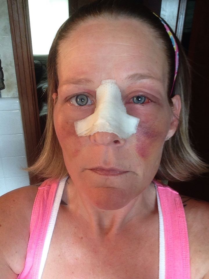 фотографии лица избил, женщину избил бывший, фото против насилия в семье, травмы лица женщина