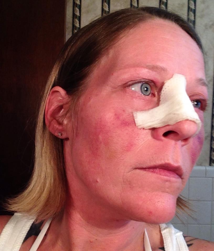 фотографии лица избил, женщину избил бывший, фото против насилия в семье, травмы лица женщина