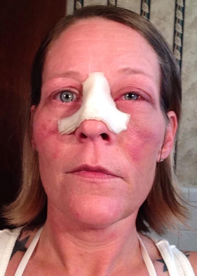 фотографии лица избил, женщину избил бывший, фото против насилия в семье, травмы лица женщина