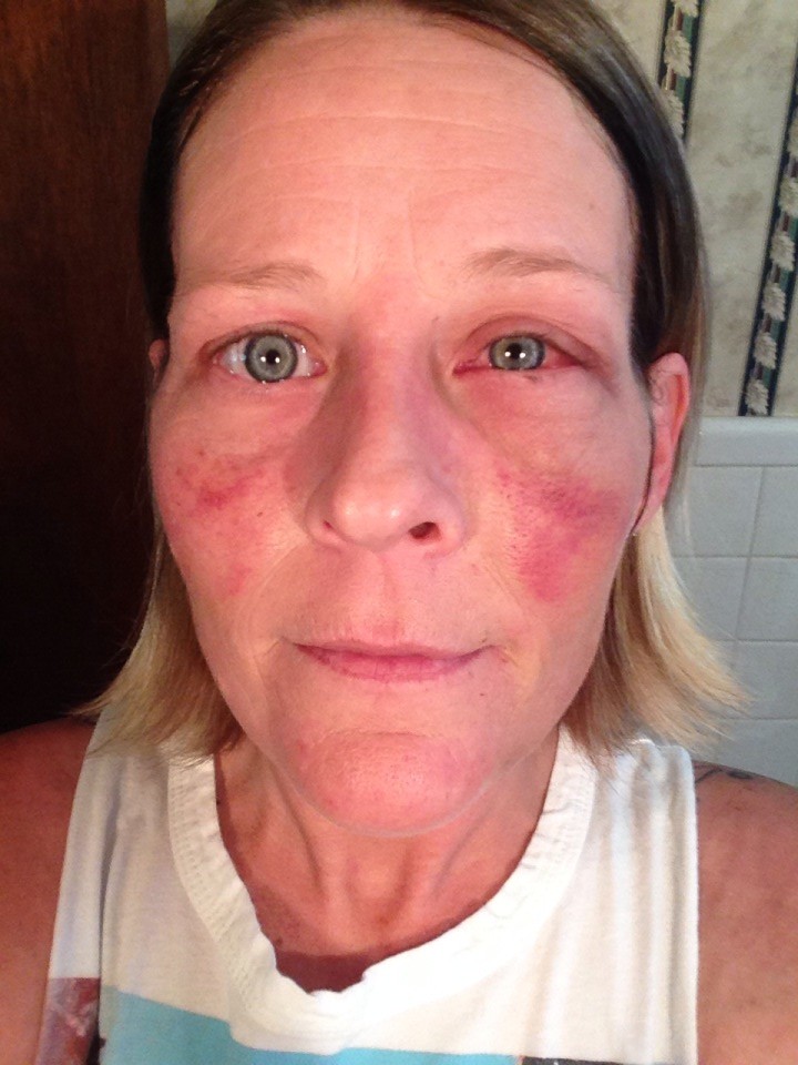 фотографии лица избил, женщину избил бывший, фото против насилия в семье, травмы лица женщина