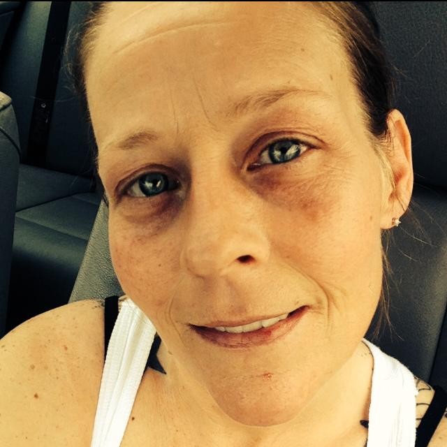 фотографии лица избил, женщину избил бывший, фото против насилия в семье, травмы лица женщина