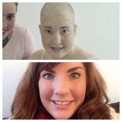 дети больные раком, дети рак до во время после, фото дети рак